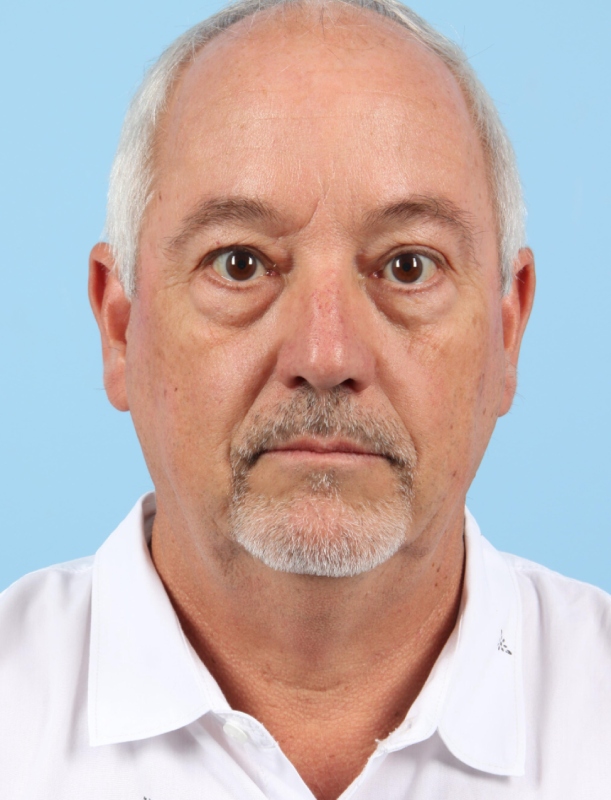 Blepharoplasty Before & After Image