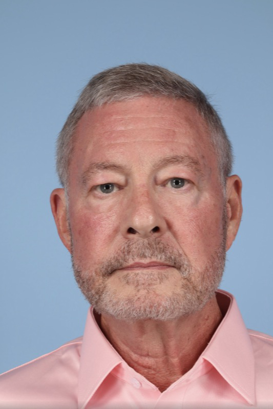 Brow Lift Before & After Image