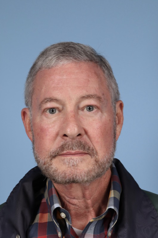 Brow Lift Before & After Image