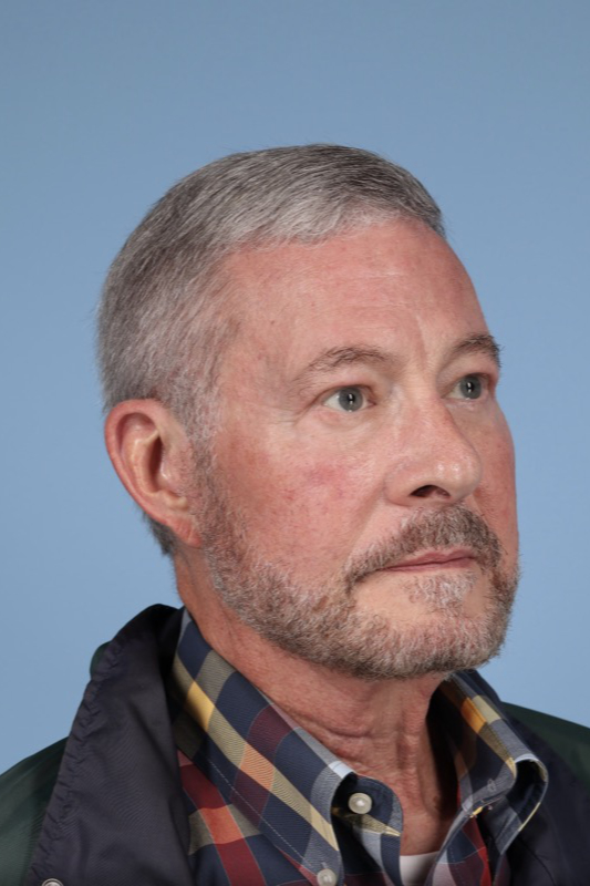 Brow Lift Before & After Image